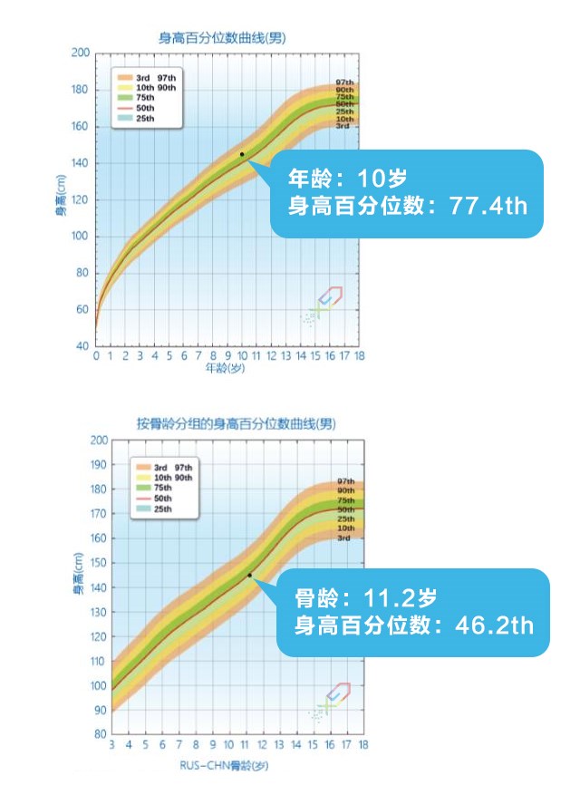 如何正确理解，科学评价孩子的身高？_06.jpg