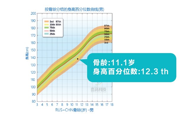 判断孩子的高矮？这3点没搞清楚会后悔！_05.jpg