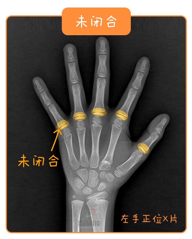 重启骨骺线~你看起来很诱人！_12.jpg