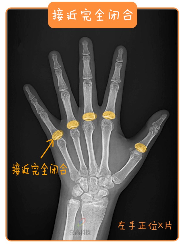 重启骨骺线~你看起来很诱人！_13.png