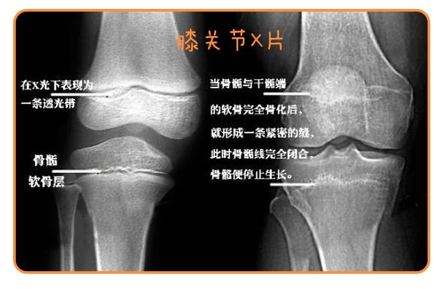 重启骨骺线~你看起来很诱人！_14.png
