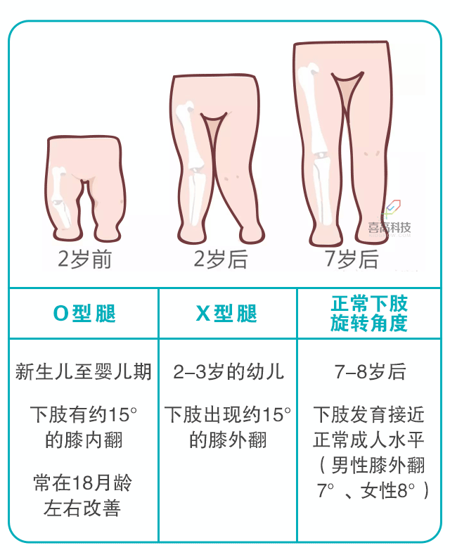 宝宝身长腿短，长大会是矮个子吗？_03.gif