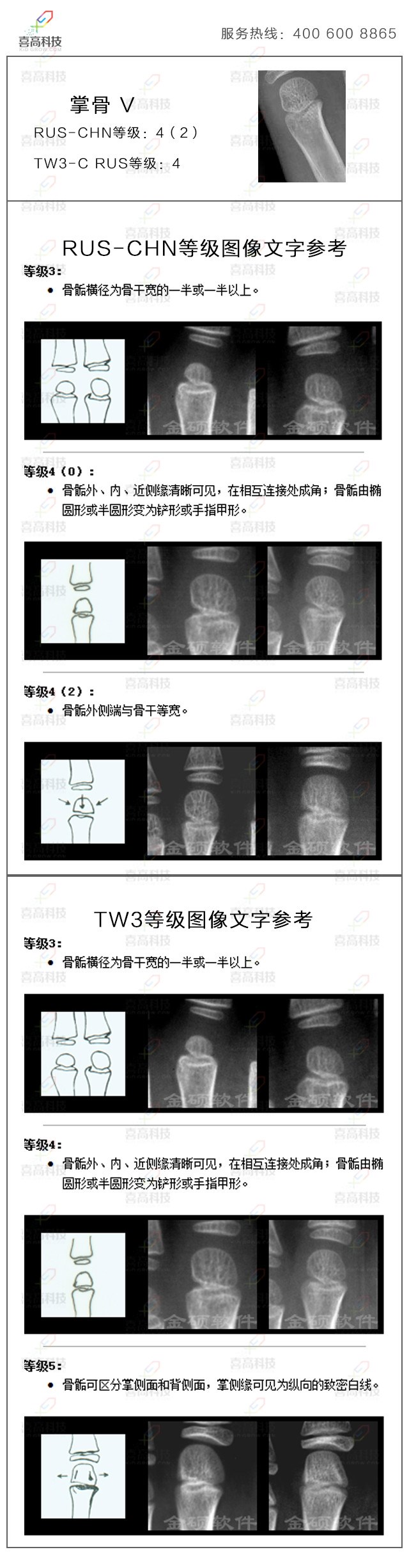 tw3-c rus是《中华-05》骨龄标准中的一种方法