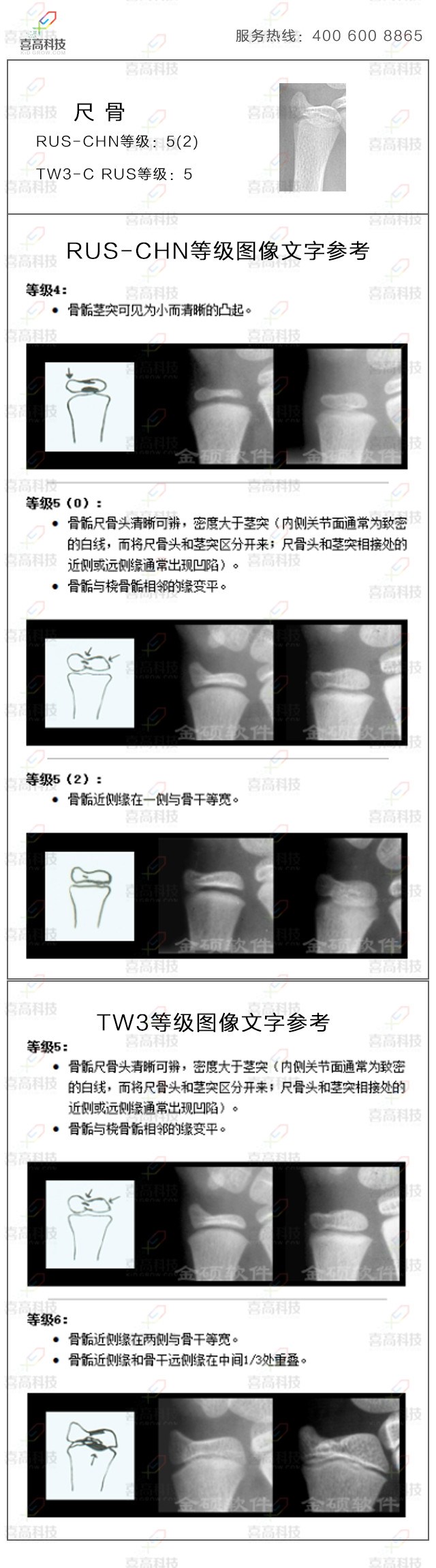 21-chigu.jpg 21-chigu.jpg